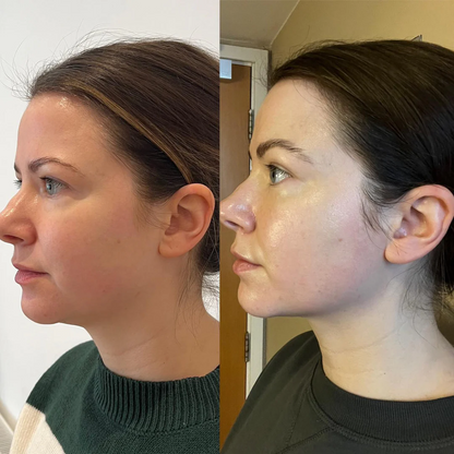 Biologische Lymfedrainage & Ontzwellende Druppels